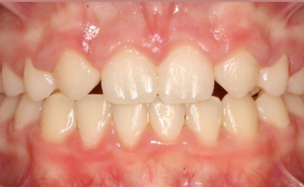 After -The Campbell Clinic