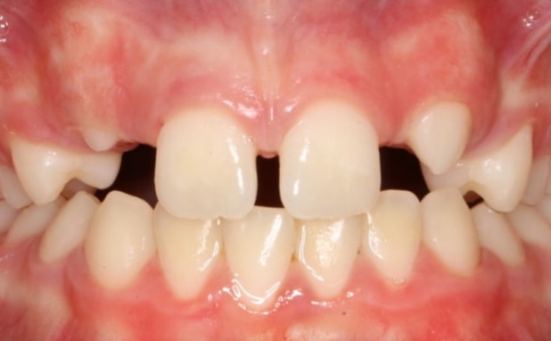 Before - The Campbell Clinic