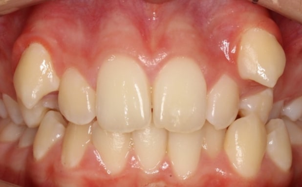 Before - The Campbell Clinic