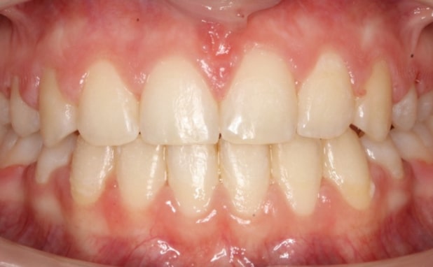 After -The Campbell Clinic