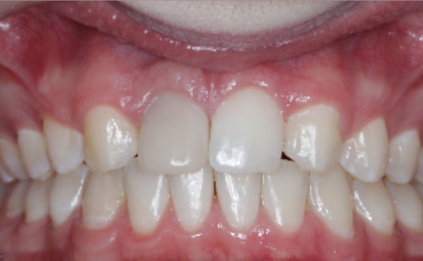 After -The Campbell Clinic