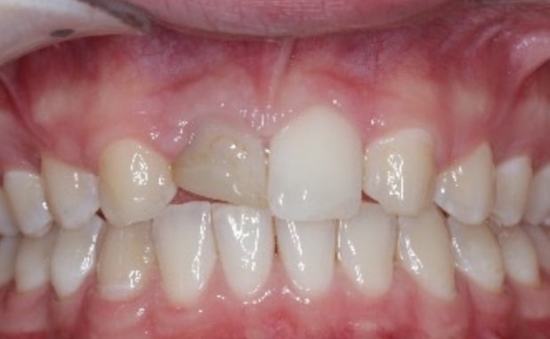 Before - The Campbell Clinic