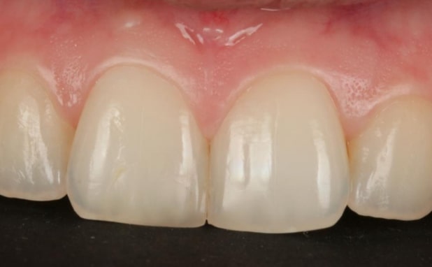 After -The Campbell Clinic