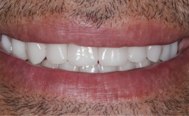 After -The Campbell Clinic