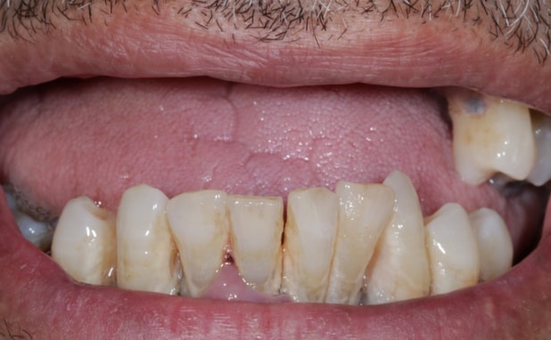 Before - The Campbell Clinic