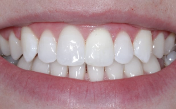 After -The Campbell Clinic