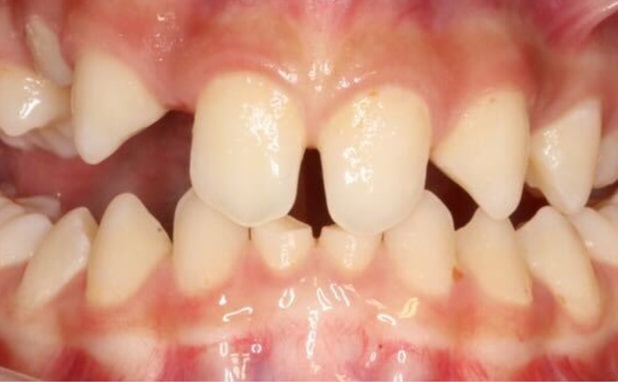 Before - The Campbell Clinic