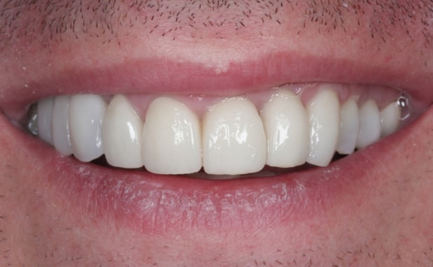 After -The Campbell Clinic