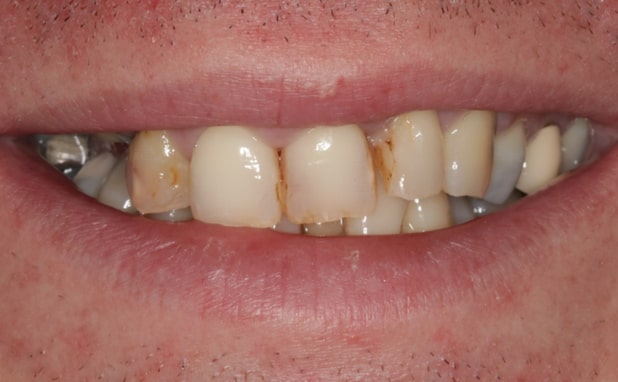 Before - The Campbell Clinic