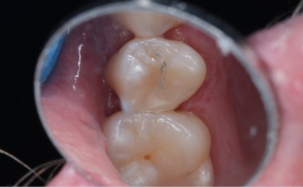 After -The Campbell Clinic