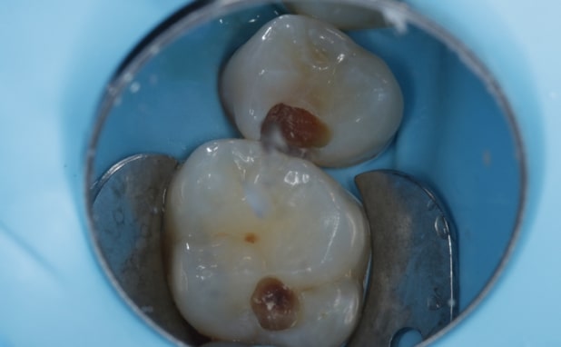 Before - The Campbell Clinic