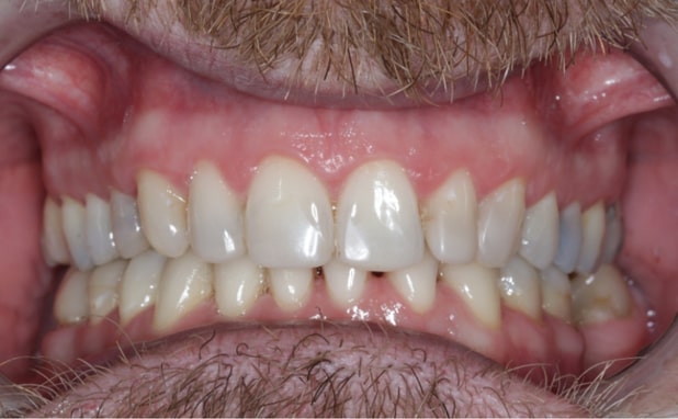 After -The Campbell Clinic