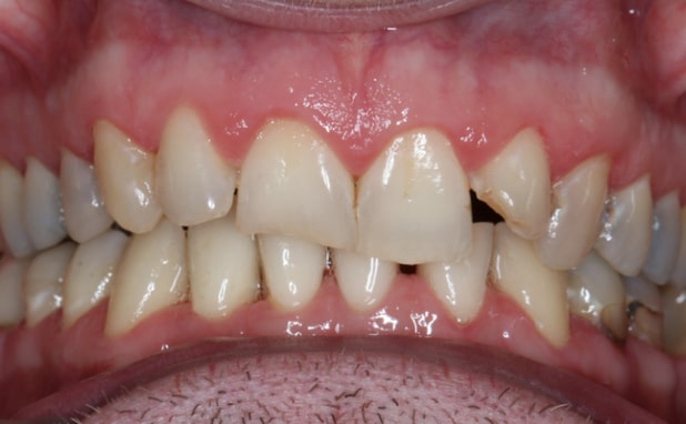 Before - The Campbell Clinic