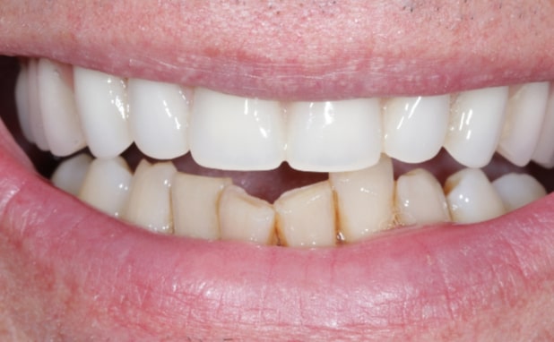 After -The Campbell Clinic