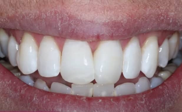 After -The Campbell Clinic