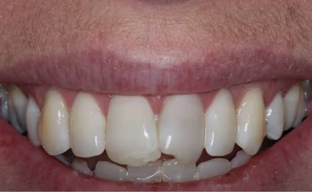 Before - The Campbell Clinic