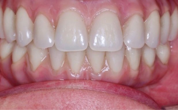 After -The Campbell Clinic