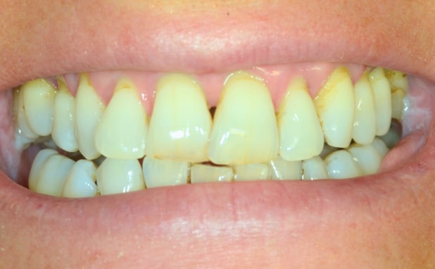 Before - The Campbell Clinic