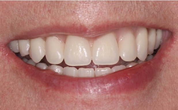 After -The Campbell Clinic