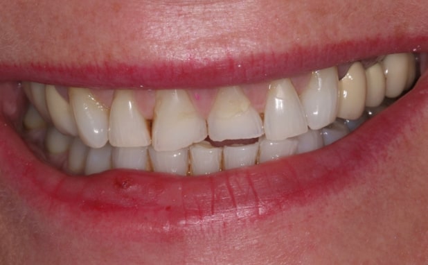 Before - The Campbell Clinic