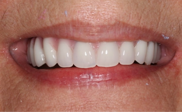 After -The Campbell Clinic