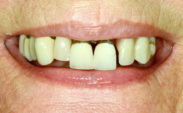 Before - The Campbell Clinic