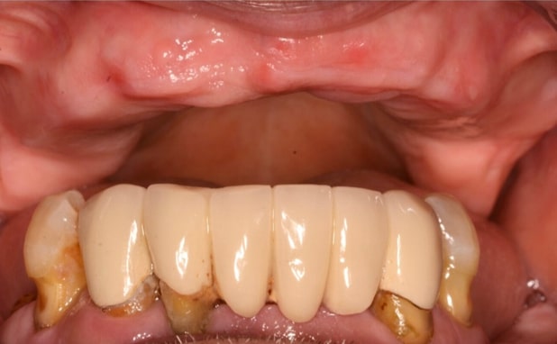 Before - The Campbell Clinic