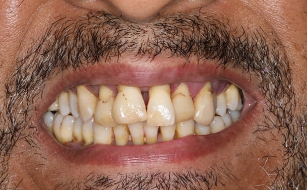 Before - The Campbell Clinic