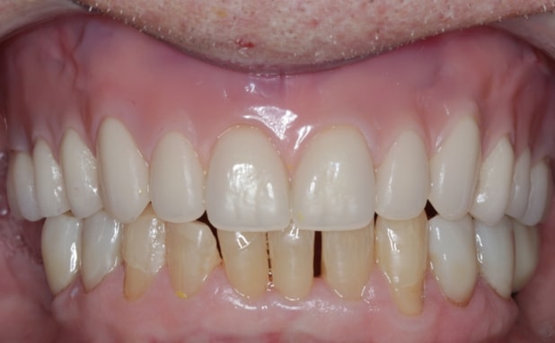 After -The Campbell Clinic