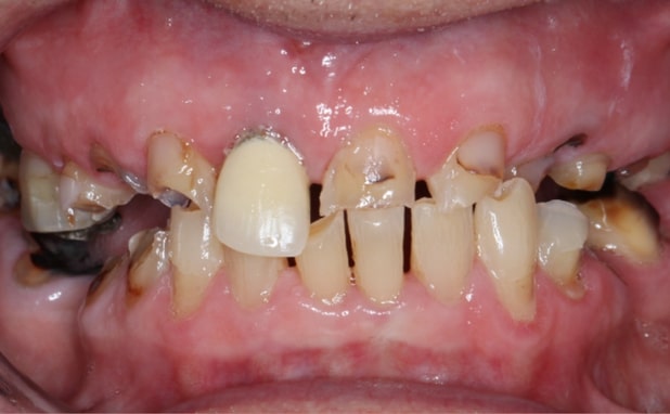 Before - The Campbell Clinic