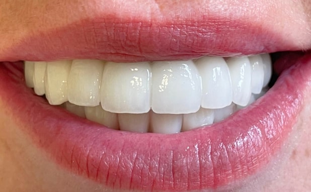 After -The Campbell Clinic