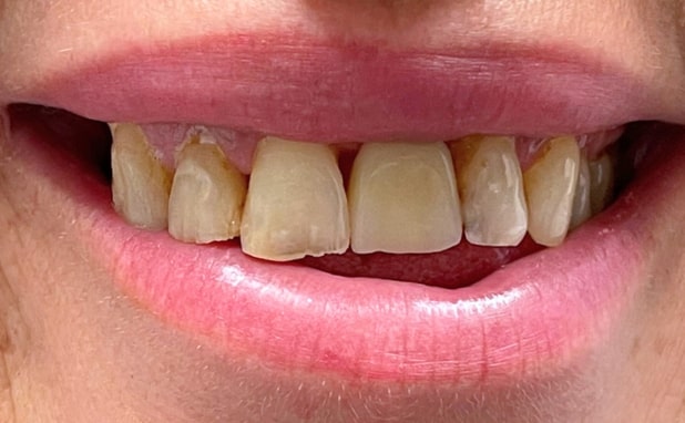 Before - The Campbell Clinic