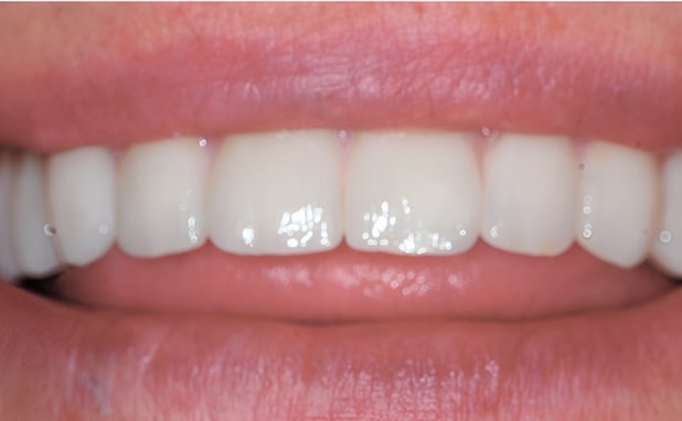 After -The Campbell Clinic