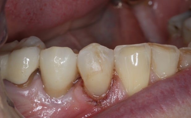 After -The Campbell Clinic