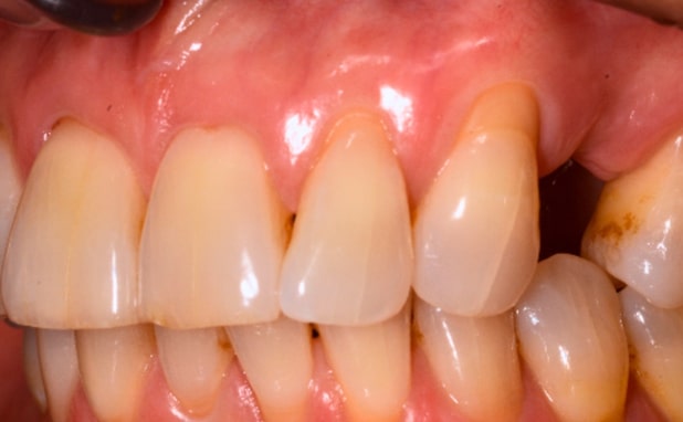 Before - The Campbell Clinic