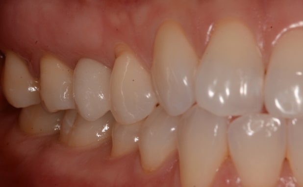 After -The Campbell Clinic