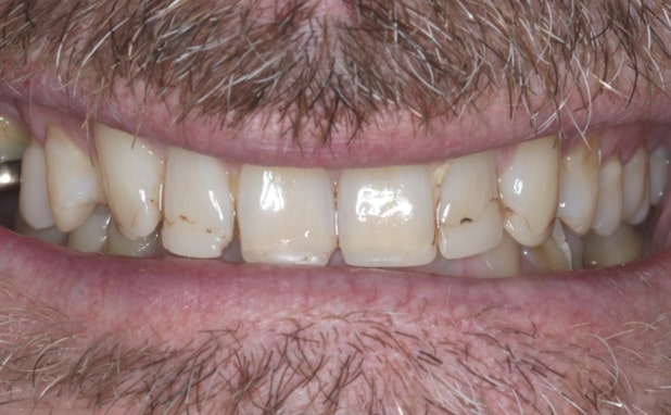 Before - The Campbell Clinic