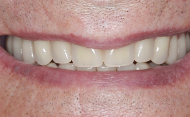 After -The Campbell Clinic