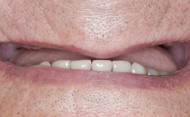 Before - The Campbell Clinic