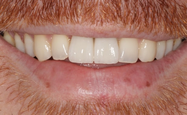 After -The Campbell Clinic