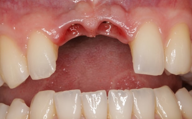 Before - The Campbell Clinic