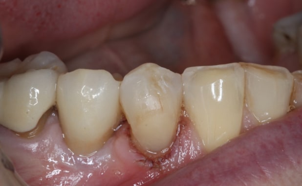 After -The Campbell Clinic