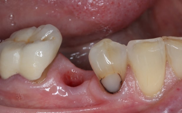 Before - The Campbell Clinic