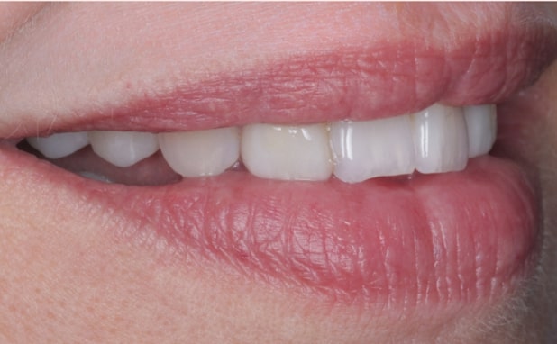 After -The Campbell Clinic