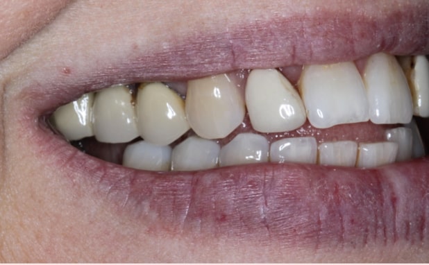 Before - The Campbell Clinic