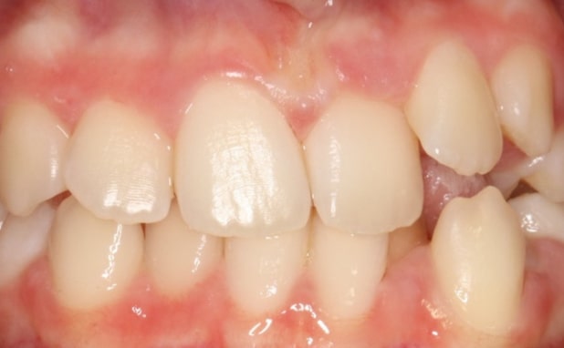 Before - The Campbell Clinic