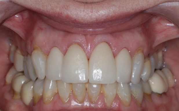 After -The Campbell Clinic