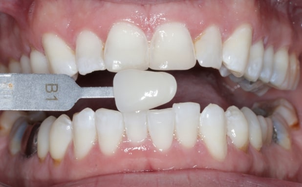 After -The Campbell Clinic