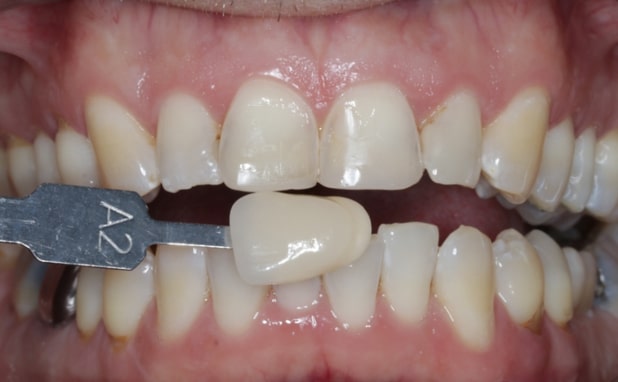 Before - The Campbell Clinic