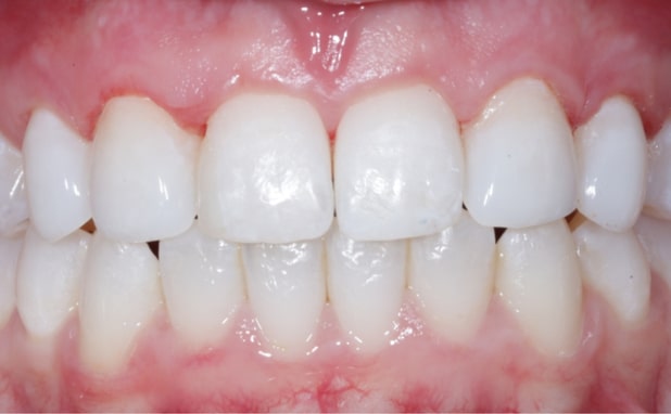 After -The Campbell Clinic